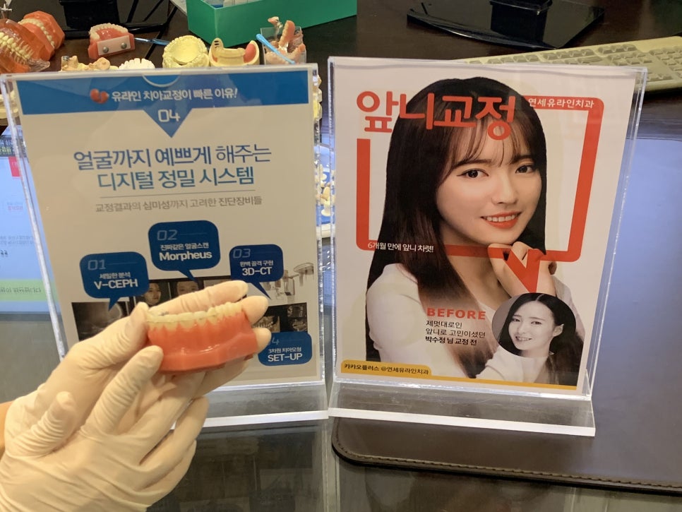 돌출앞니부분교정 입 열기 두려웠다면 관련 이미지 5
