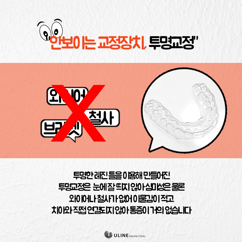 동작구치과 투명교정후기 꿀정보 관련 이미지 8