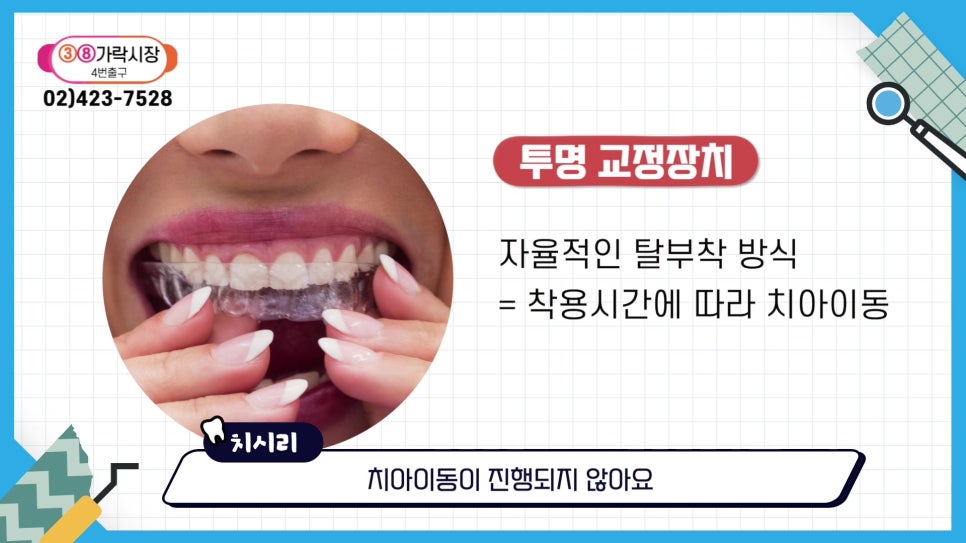 신림동치과 - 안 보이는 투명교정의 모든것 관련 이미지 21