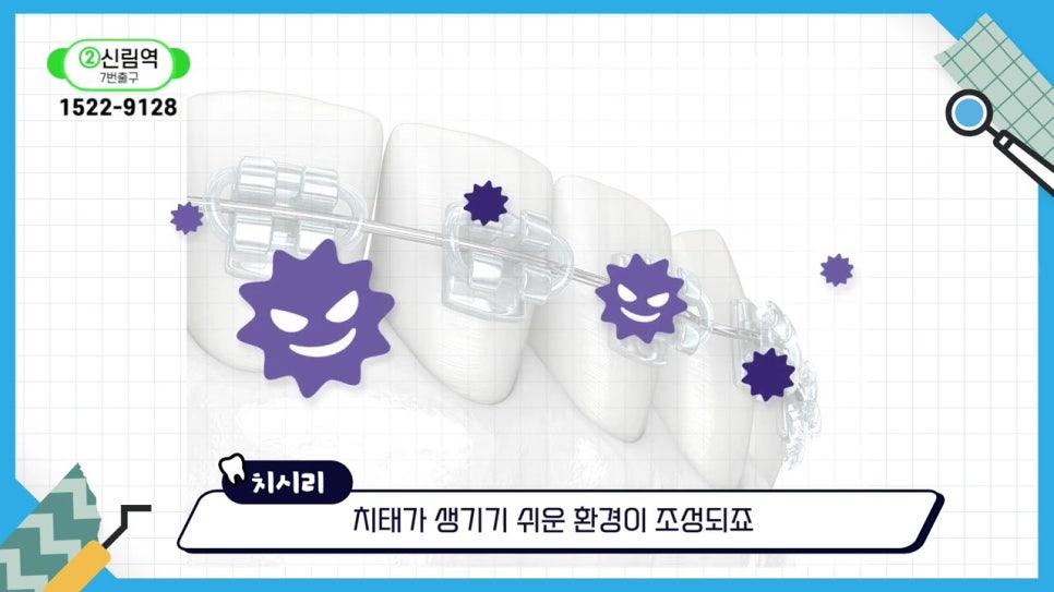 관악구치아교정, 빨리 끝내고 싶어? 관련 이미지 11