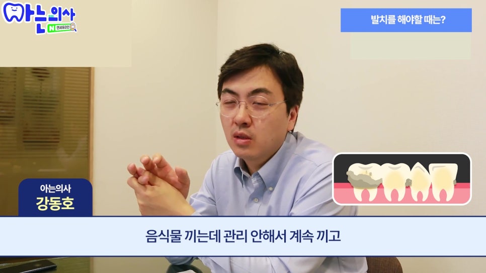 신림동치과 - 흔들리지 않는데 왜 발치하라고 할까? 관련 이미지 14