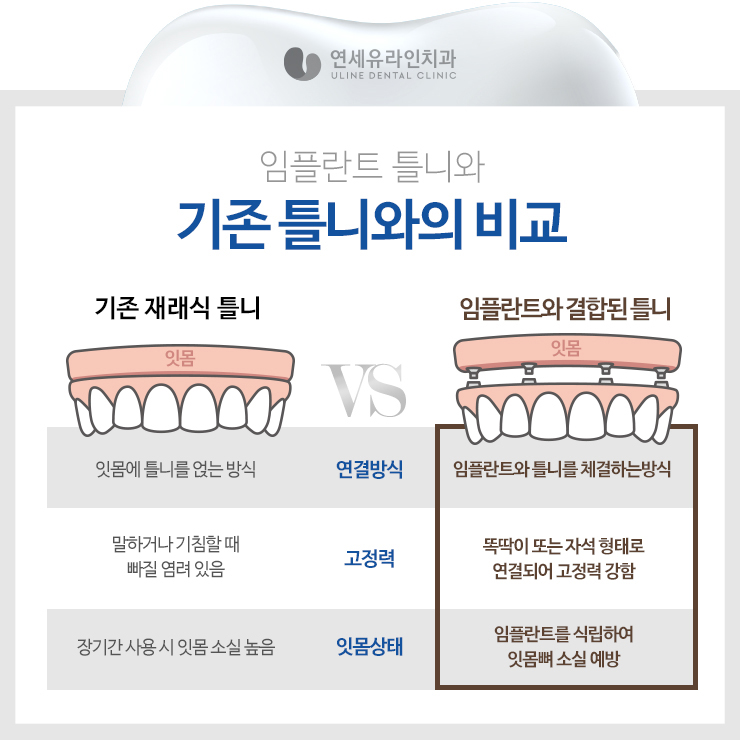 임플란트틀니비용 부담적어 기쁨 관련 이미지 4