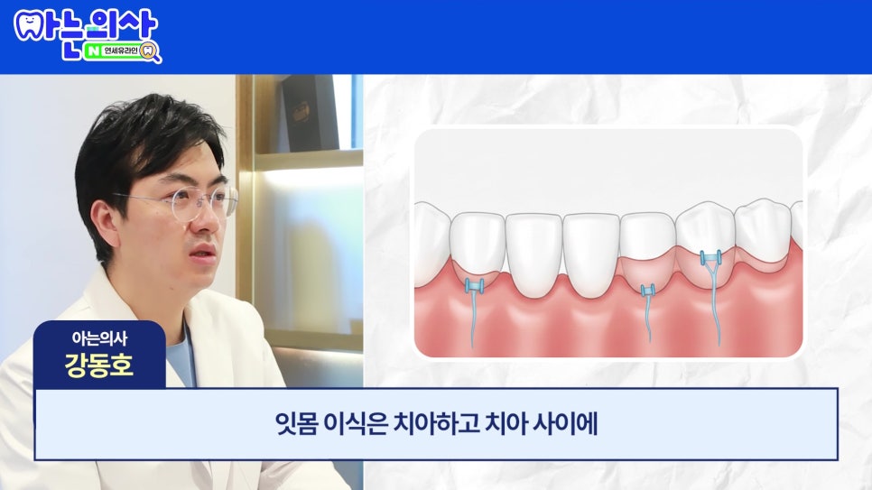 관악구 신림동치과 - 치아가 길어보이는 이유 관련 이미지 23