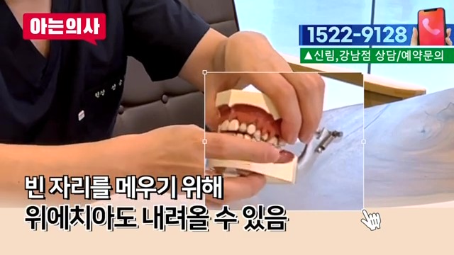 해외거주 중 한국에서 임플란트를? 가락동치과 관련 이미지 19
