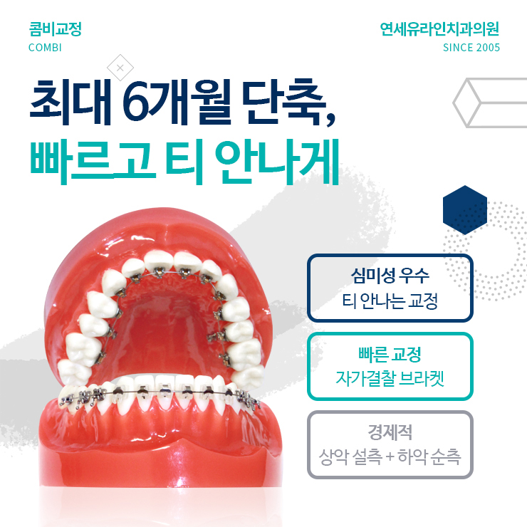 서울대입구역치과 예쁨 빵빵 터져라 관련 이미지 5