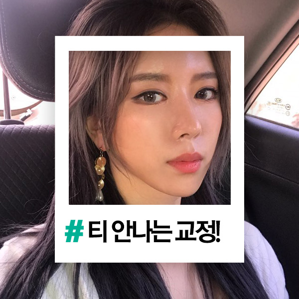 관악구치과 웃는게 예쁜 사람이 되어 관련 이미지 1
