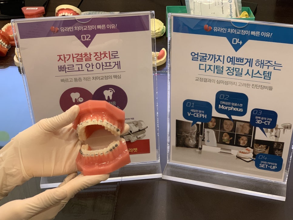 설측교정비용 다양한 요소의 장점들 관련 이미지 4