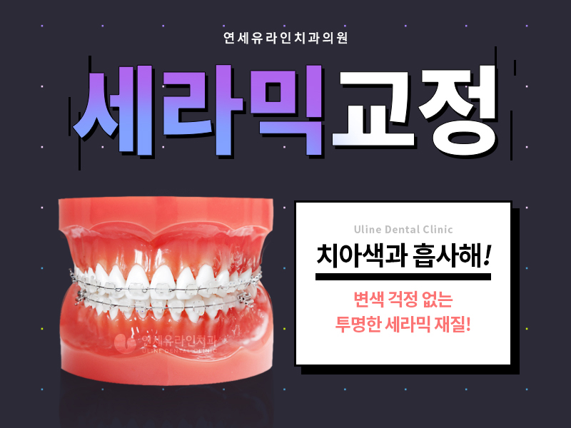 돌출입 세라믹교정 메탈교정 뭐가 좋을까! 관련 이미지 5