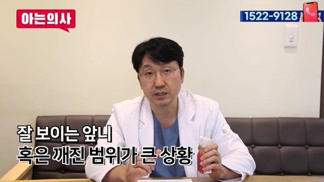 치아 부러짐, 파절엔 임플란트가 답? 관련 이미지 14