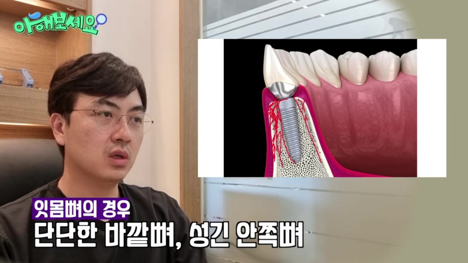 역삼역임플란트치과, 젊은층도 실패를? 관련 이미지 14