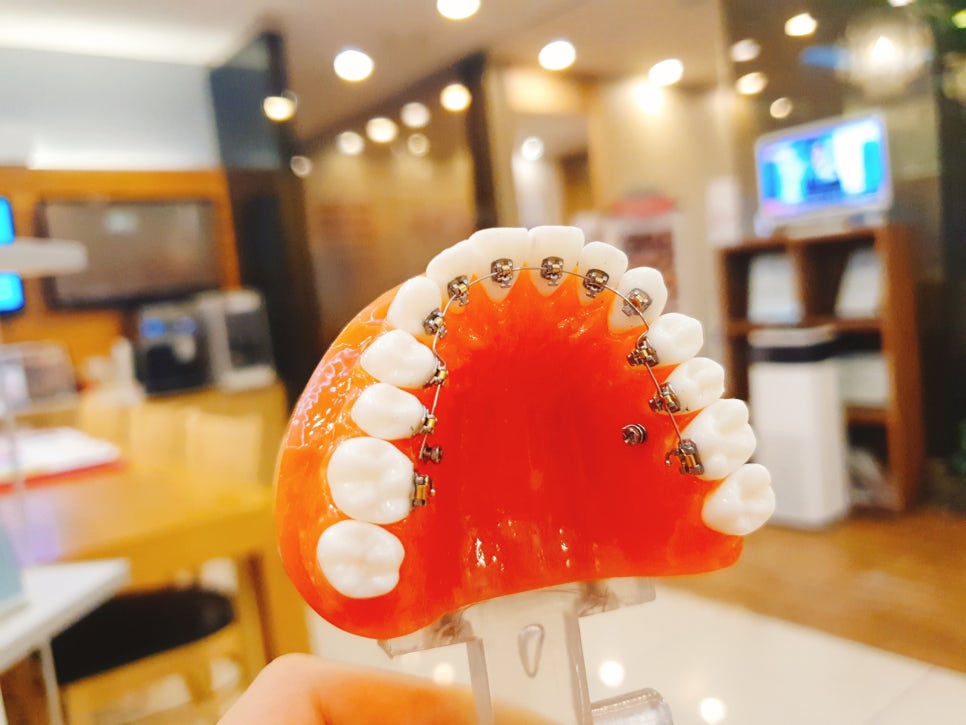 봉천역치과 여러분들의 취향 존중해요! 관련 이미지 3