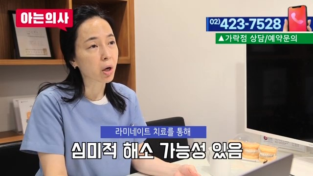 라미네이트가 유리한 케이스는? 관련 이미지 14