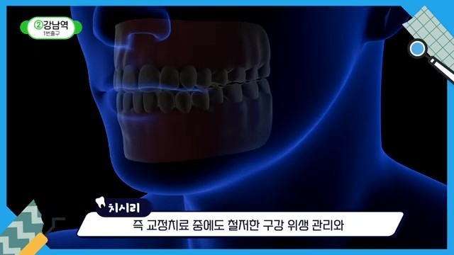Do Braces Weaken Your Gums? A Fact Check by a Sinlim Dental Clinic image 32