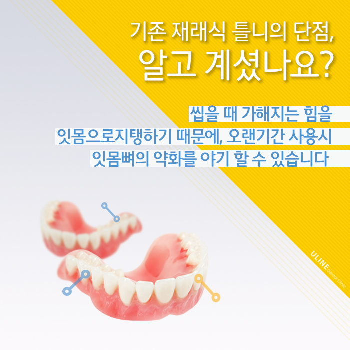 신림동치과 임플란트틀니비용 좋을수밖에! 관련 이미지 3