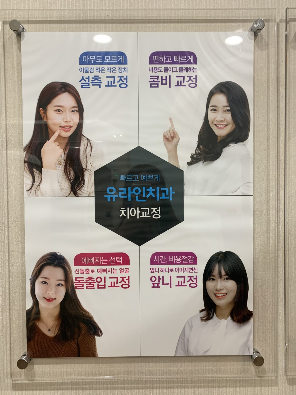 토끼앞니교정 극복 방법은 어떻게? 관련 이미지 3