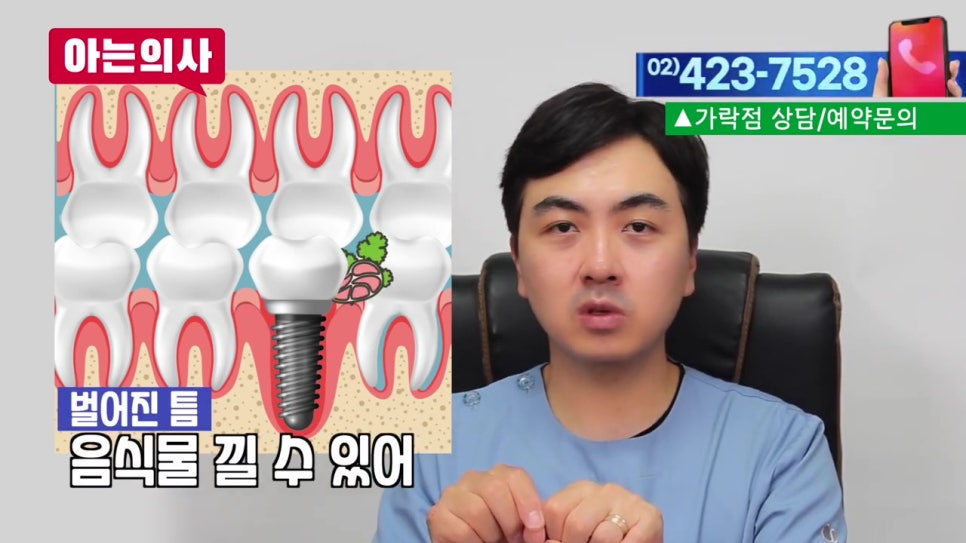 강남역임플란트 후 음식물 왜 끼지? 관련 이미지 27