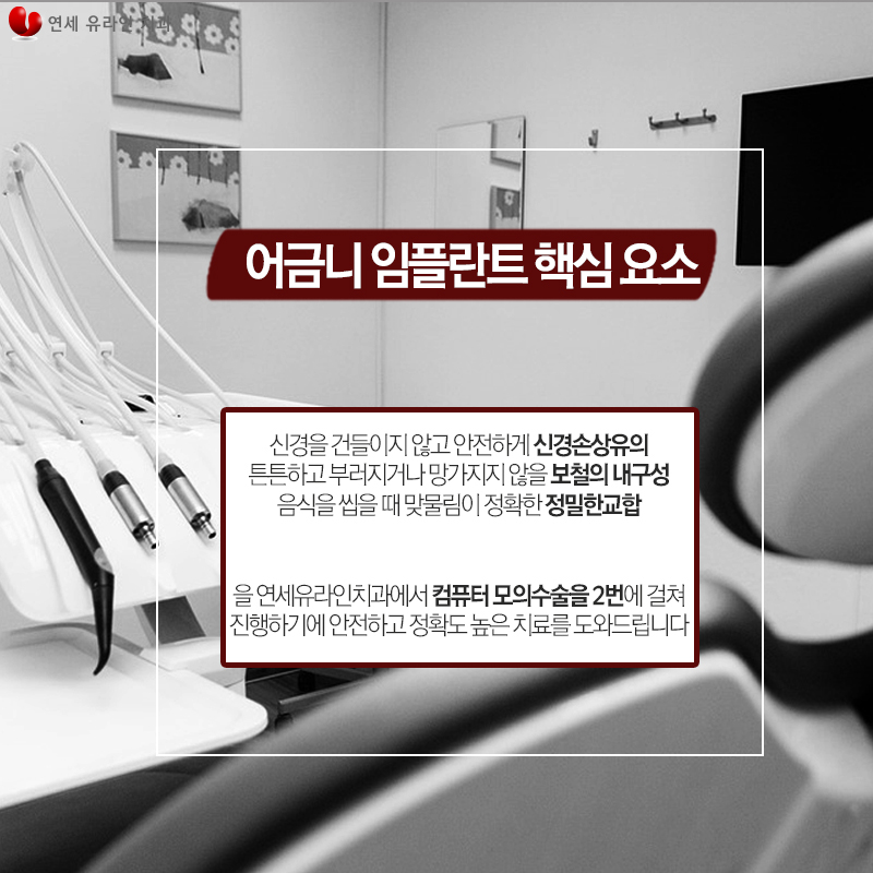 어금니임플란트가격 걱정을 내려줄 관련 이미지 4