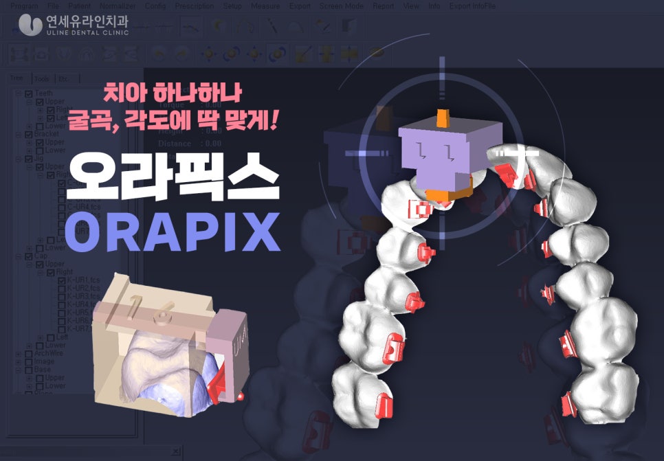 방배동치과 미소천사가 되어버렸어 관련 이미지 4