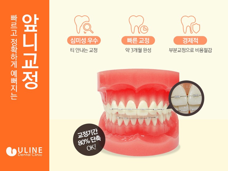 앞니교정후기 빠르니까 저렴하니까 관련 이미지 3