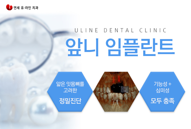 앞니임플란트잘하는곳 검색그만 여기로 관련 이미지 5