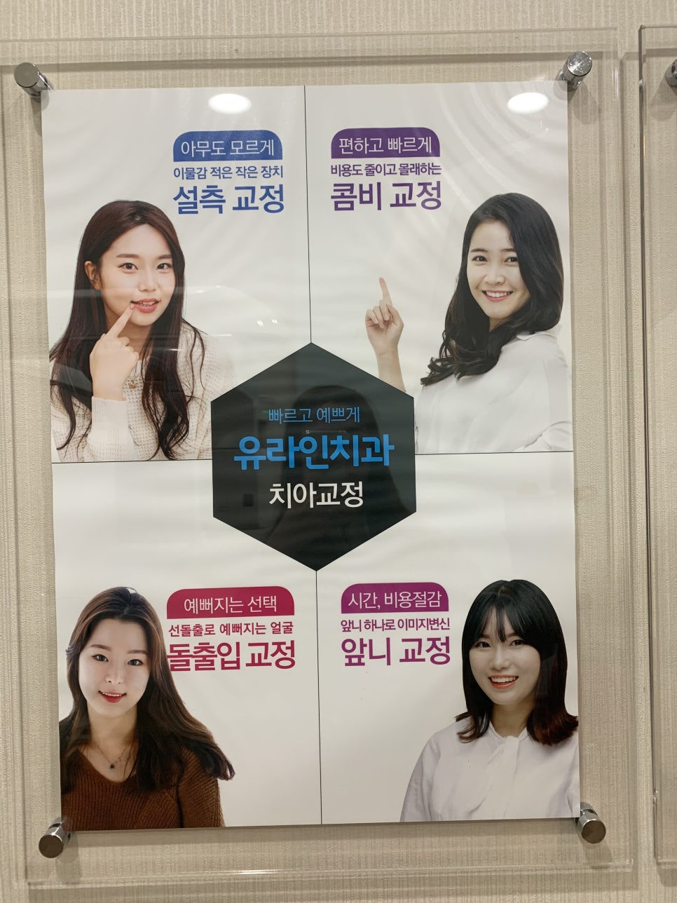 돌출앞니부분교정 입 열기 두려웠다면 관련 이미지 1