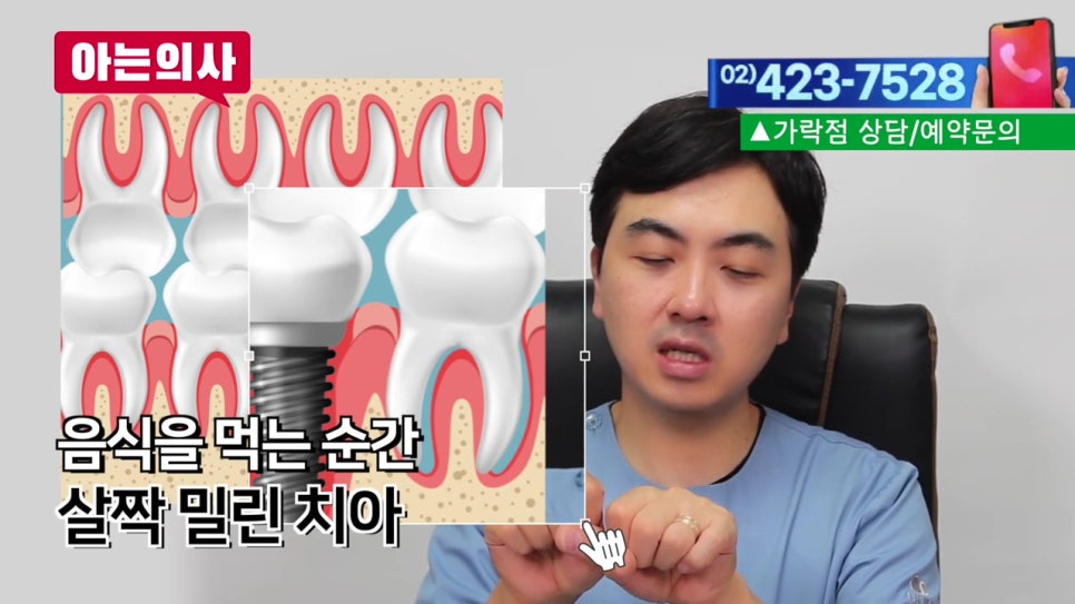 강남역임플란트 후 음식물 왜 끼지? 관련 이미지 26