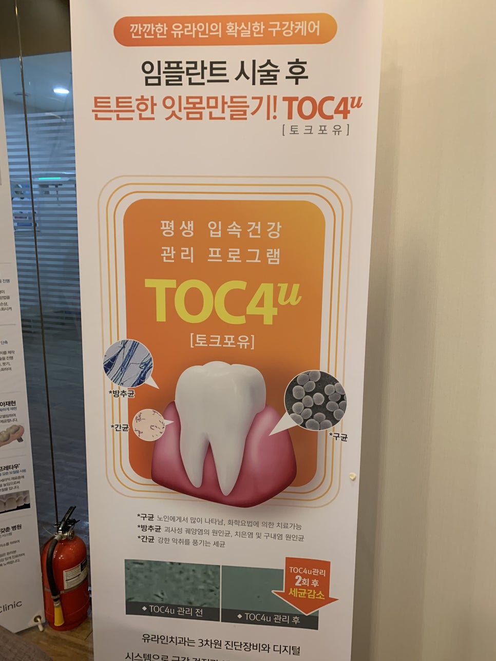 임플란트이용틀니 가격 가장 주목받고 있죠 관련 이미지 5