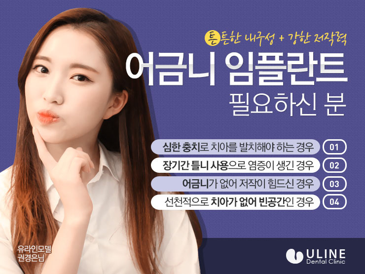 임플란트후기 맛있는 식사가 가능! 관련 이미지 3