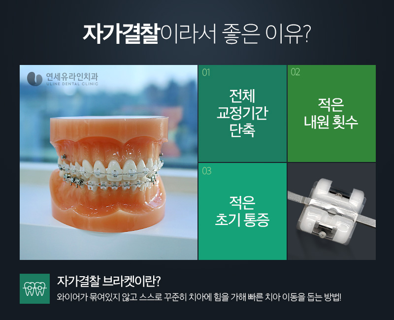 관악구치과 빠른 스피드에 감탄사! 관련 이미지 4