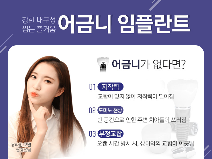 동작구치과 치아없는 불편함을 개선 관련 이미지 2