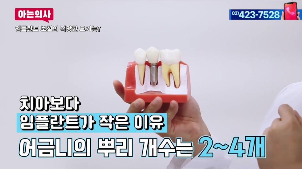 임플란트, 내 치아보다 작은 이유는 관련 이미지 1