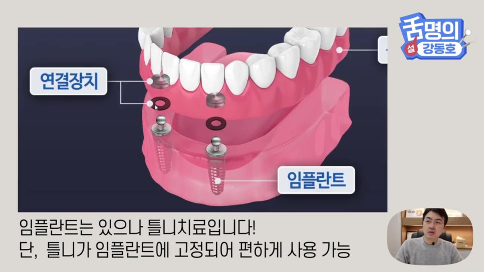 신림동치과, 다수의 치아상실 후.. 관련 이미지 16