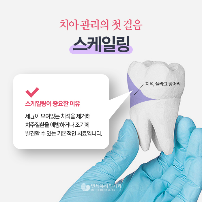 서울대입구역치과 치아 관리에 대한 협조 필수! 관련 이미지 7