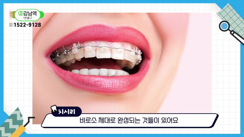 관악구치아교정, 빨리 끝내고 싶어? 관련 이미지 4