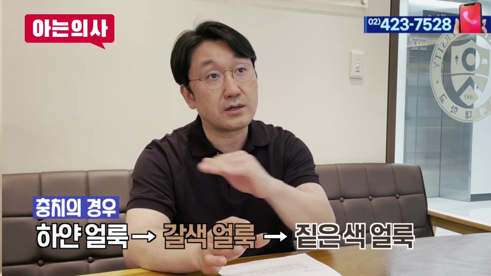 송파구 가락동치과 - 치아 하얀 점, 치료해야 할까? 관련 이미지 6