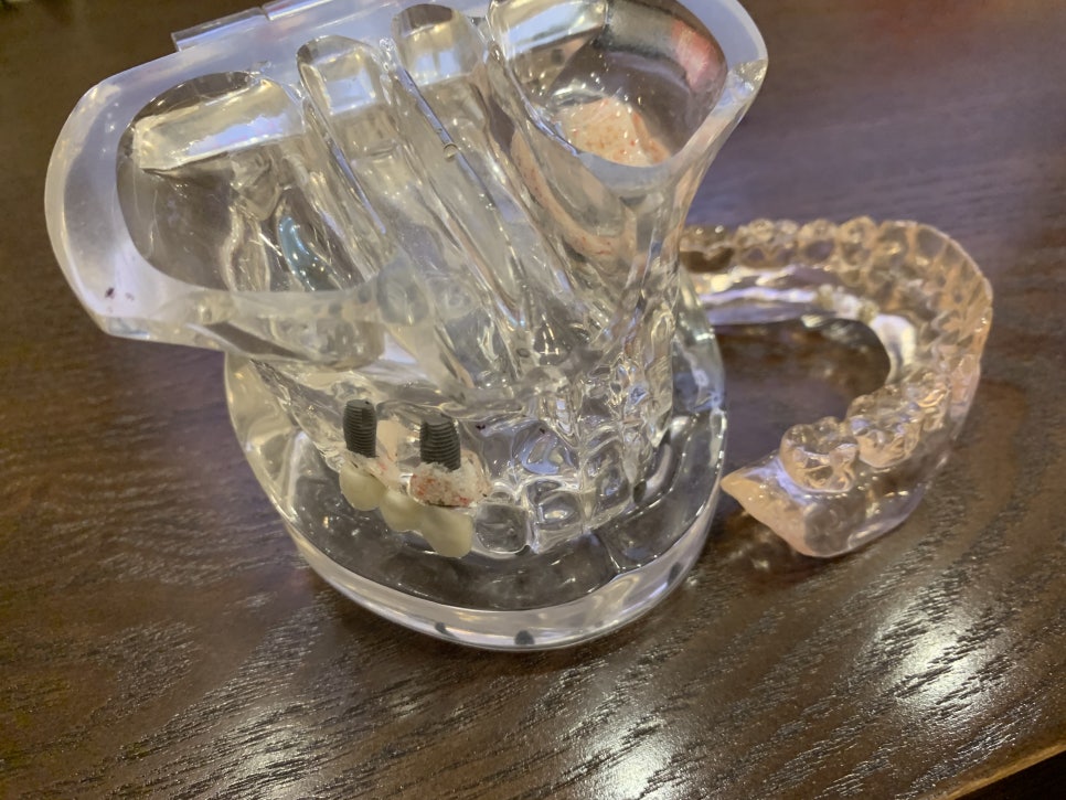 역삼역치과 약속은 소중하게, 지켜야죠! 관련 이미지 1