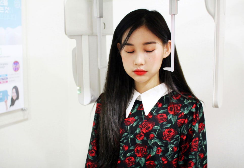 앞니부분교정가격 플렉스 해버렸지 뭐야 관련 이미지 8