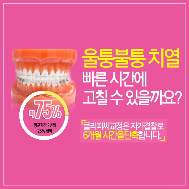 클리피씨교정후기 찜꽁했어♡ 관련 이미지 6