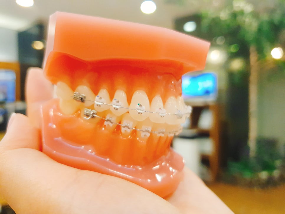 서울대입구역 치아신경치료 치과 선택해보기 관련 이미지 3