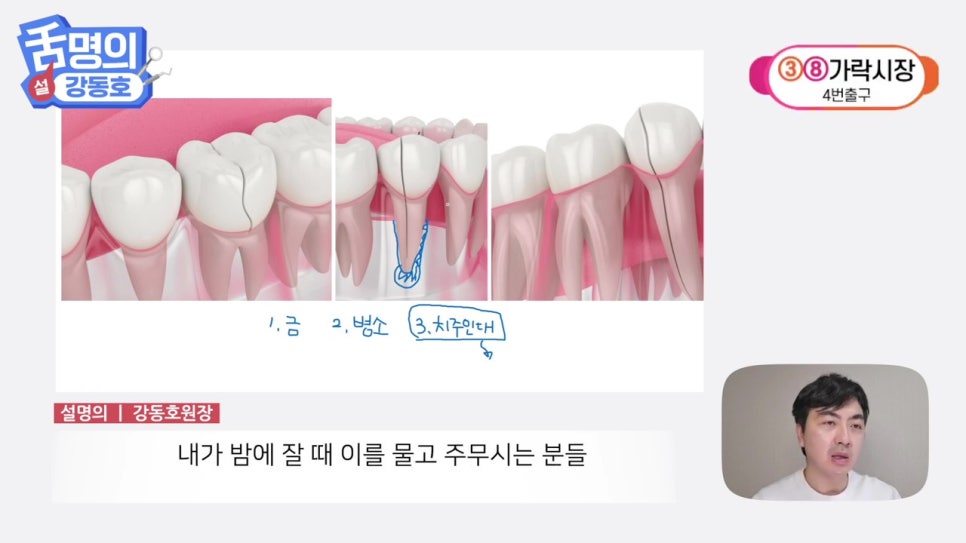 역삼역야간진료치과, 씹을 때마다 아파? 관련 이미지 28