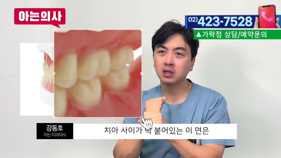 신림동치과 - 치실 안 쓰면 충치 생긴다? 관련 이미지 5