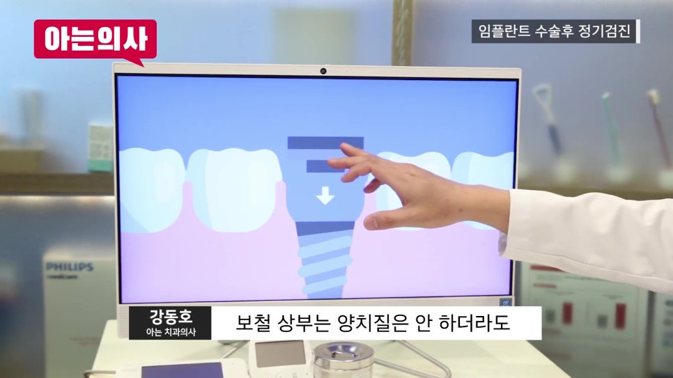 신림역임플란트 후, 정기검진 안 하면 관련 이미지 12