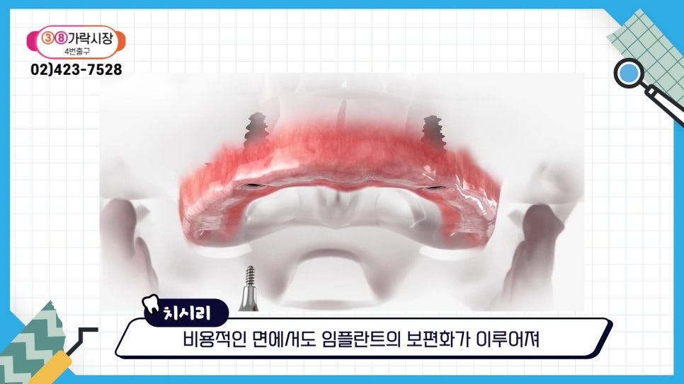 Sillim-dong Dentist — If You Want to Keep Your Natural Teeth for Life image 13