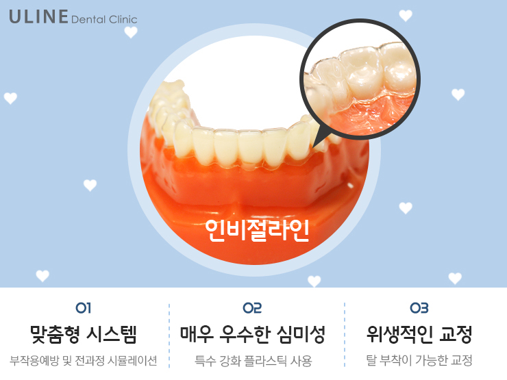 돌출입 투명교정 하고프면 여기루~~ 관련 이미지 3