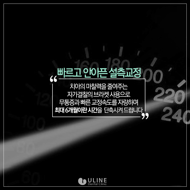 설측교정후기 제대로 알고 스타트! 관련 이미지 7