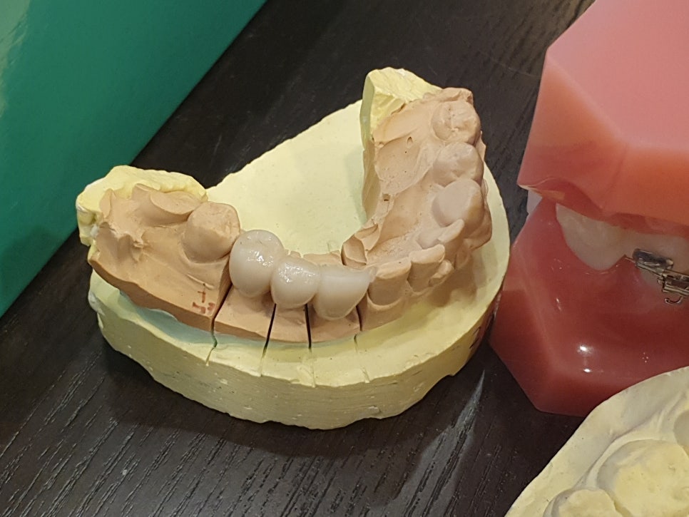 관악구 스케일링 입안청소해요 관련 이미지 5