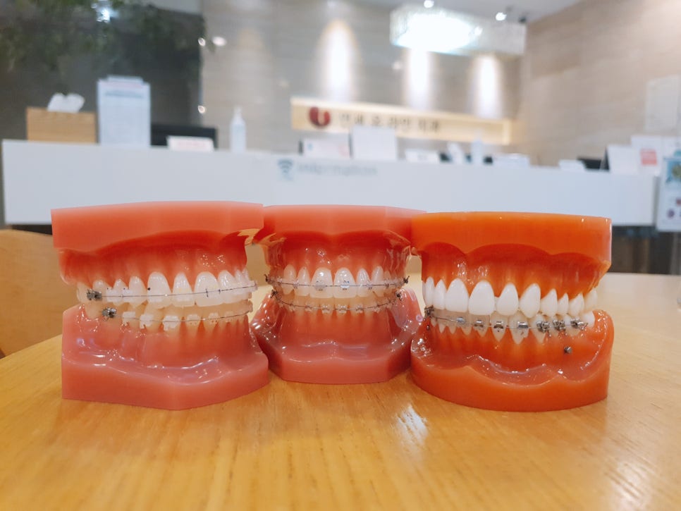 서울대입구역 치아신경치료 치과 선택해보기 관련 이미지 2