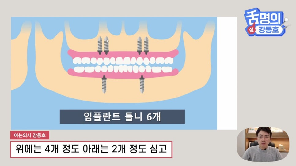 신림동치과, 다수의 치아상실 후.. 관련 이미지 18