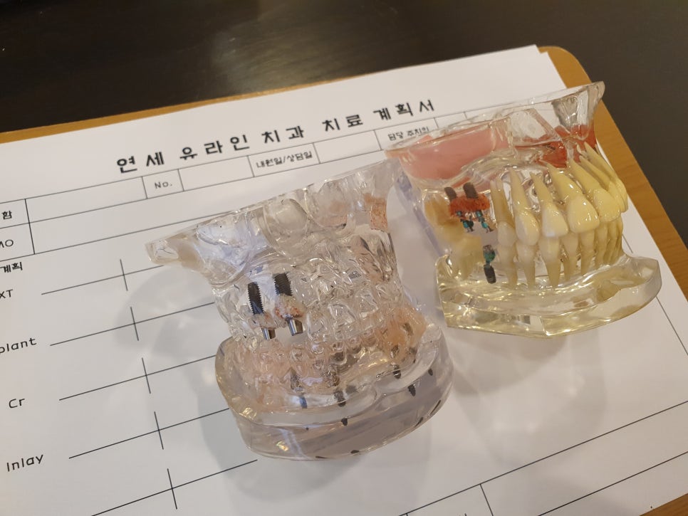 신림역 치주염 질환 잇몸이주는 적신호 관련 이미지 2