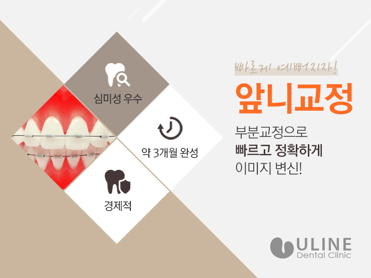 앞니교정후기 빠르니까 저렴하니까 관련 이미지 4